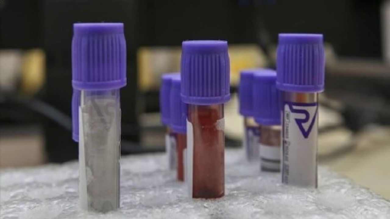 Yeni kan testi, Parkinson hastalığına umut olabilir