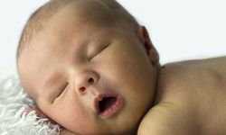 Bebeklerdeki kafa şekil bozukluğu sadece yatış pozisyonundan kaynaklanmayabilir