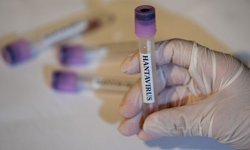 Hantavirüs enfeksiyonu erken dönemde grip ile karıştırılabiliyor