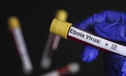 Tabipler Birliği’nden Ebola salgınına karşı ulusal eylem planı çağrısı
