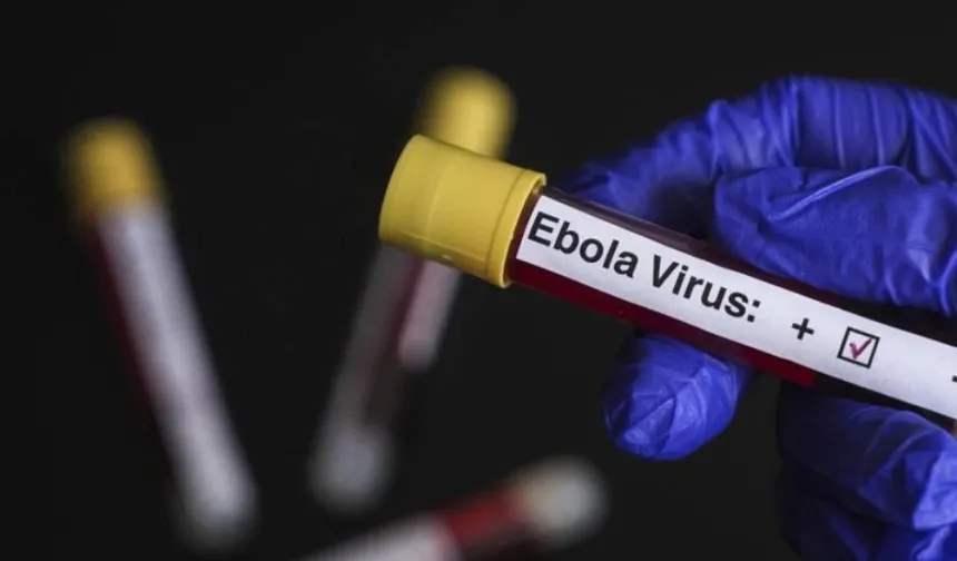 Tabipler Birliği’nden Ebola salgınına karşı ulusal eylem planı çağrısı